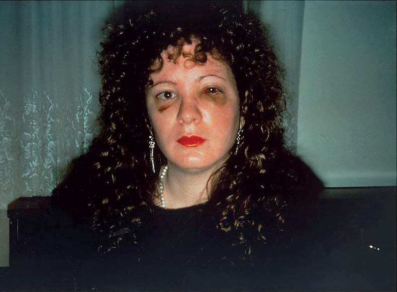 <p><b>Nan Goldin</b>, <i>Nan One Month After Being Battered</i>, 1984.</p>